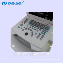 DW-500 Schwangerschaftsultraschall und tragbarer schwangerer Ultraschallscanner